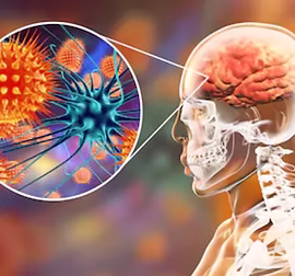 CNS Infections