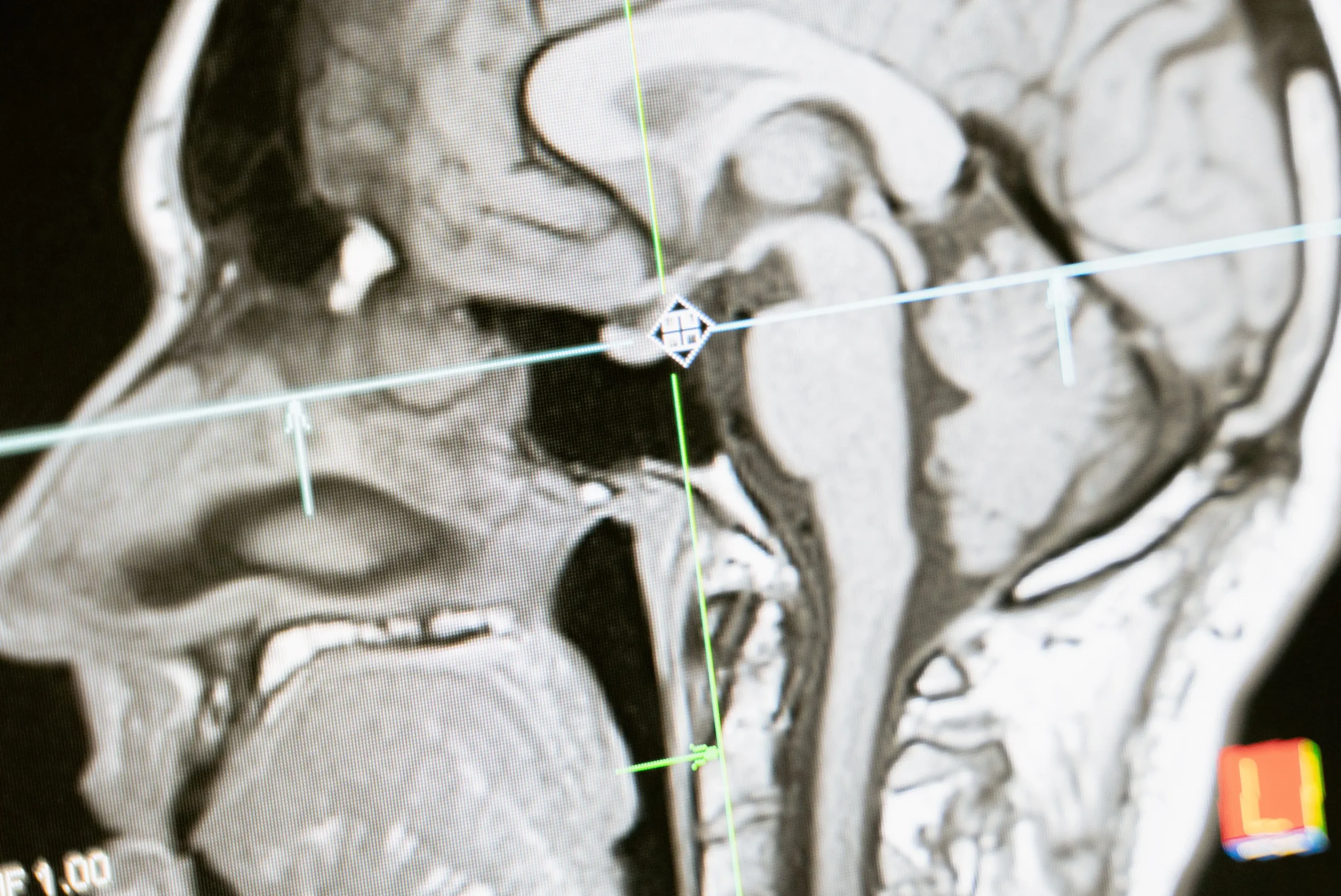 cdm neurology centre in zimbabwe dr mutama godknows kangara spine doctors (13)