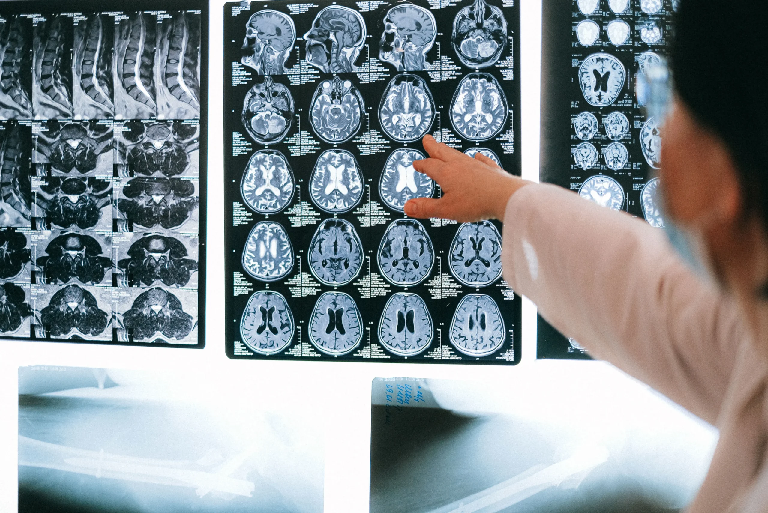 cdm neurology centre in zimbabwe dr mutama godknows kangara spine doctors (20)