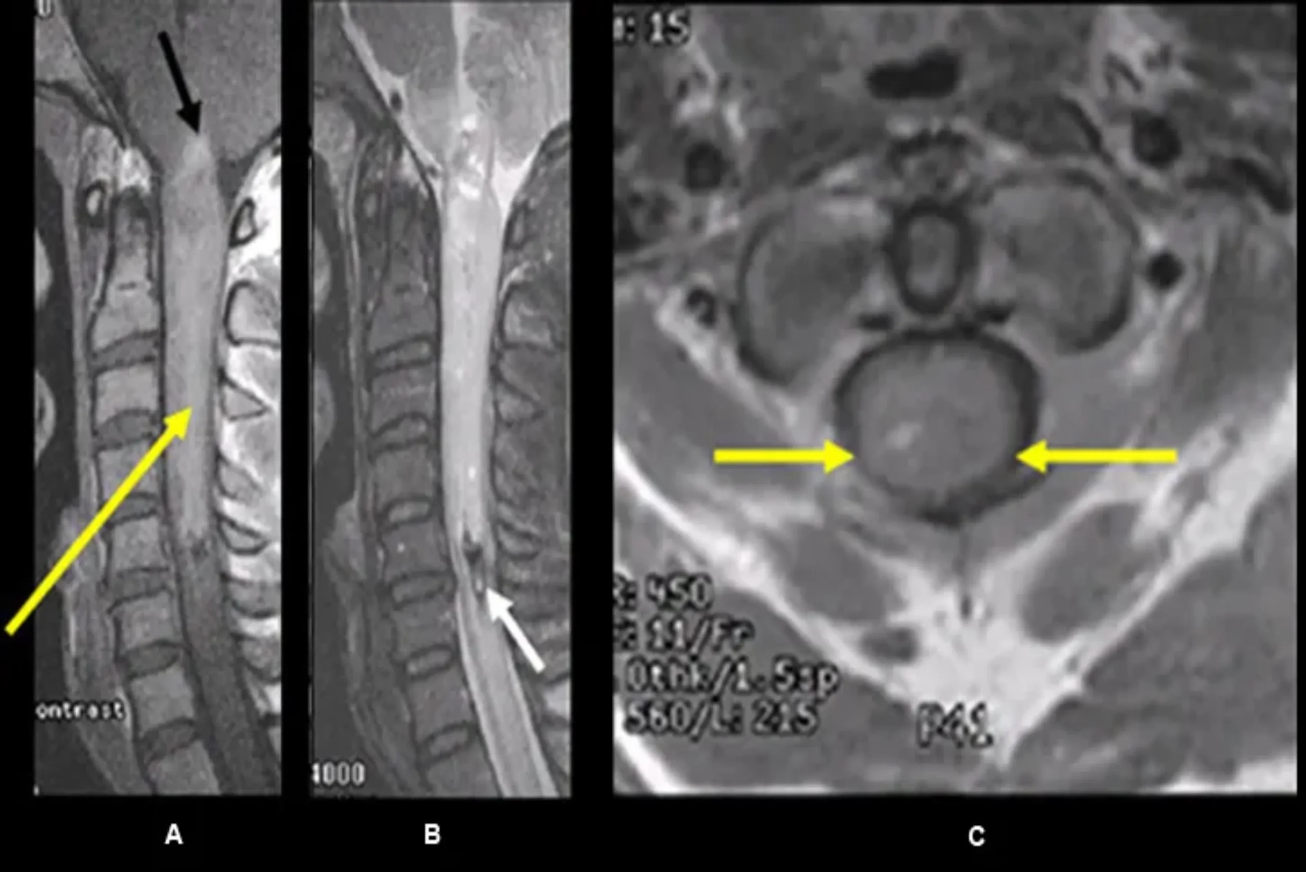 cdm neurology centre in zimbabwe dr mutama godknows kangara spine doctors (25)